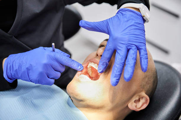 Best Emergency Treatment for Dental Infections or Abscesses in Richfield Springs, NY